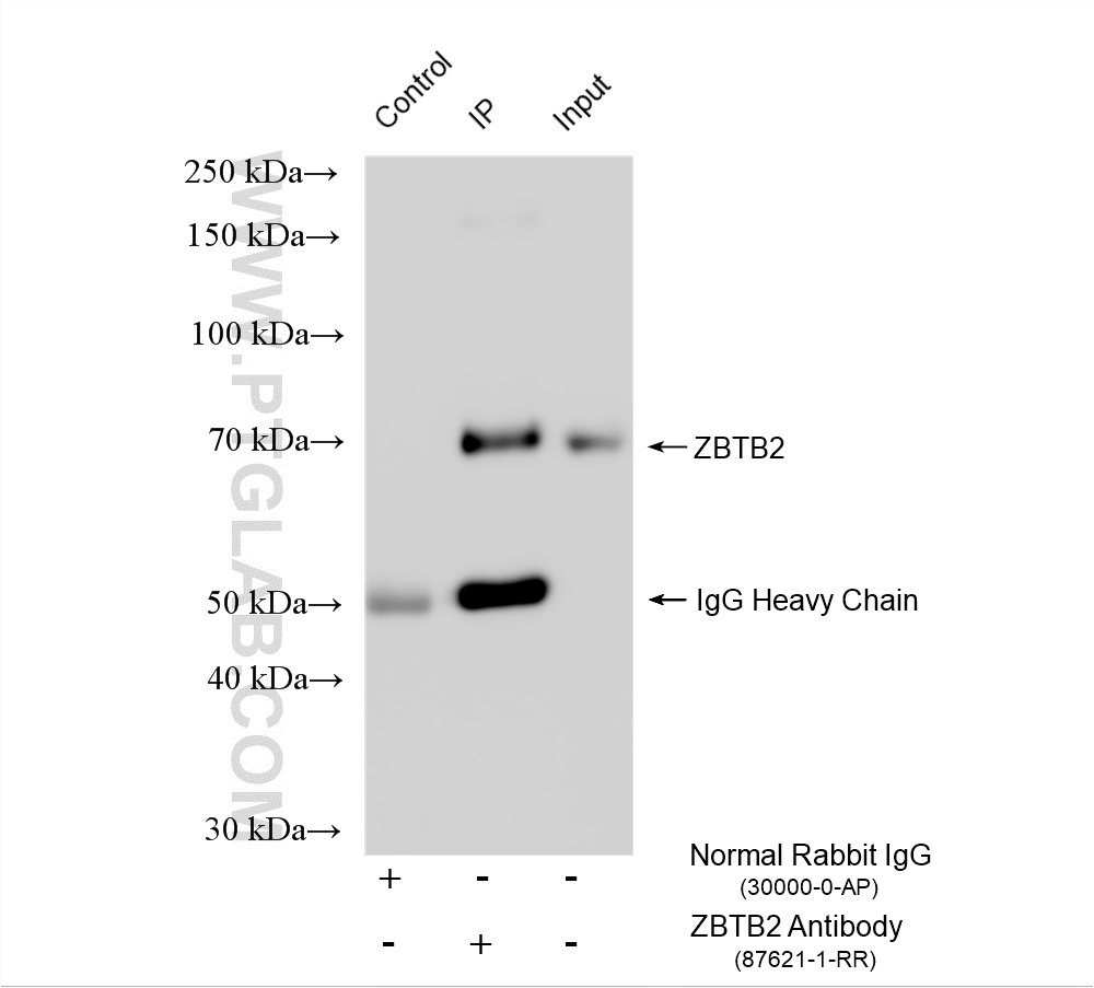 IP experiment of K-562 using 87621-1-RR IP experiment of K-562 using 87621-1-RR