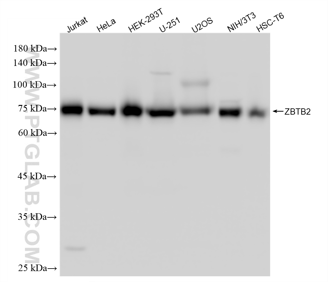 WB analysis using 87621-1-RR (same clone as 87621-1-PBS)