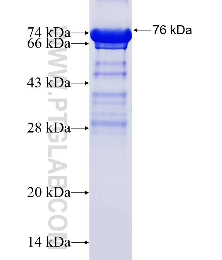 ZBTB2 fusion protein Ag24041 SDS-PAGE