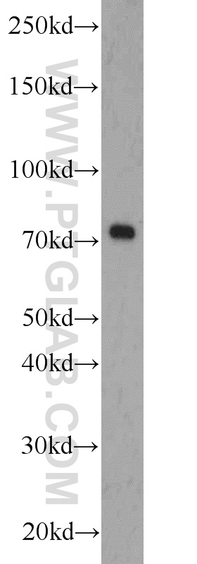 WB analysis of L02 using 23987-1-AP