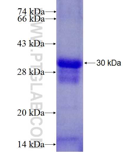 ZBTB24 fusion protein Ag24458 SDS-PAGE ZBTB24 fusion protein Ag24458 SDS-PAGE