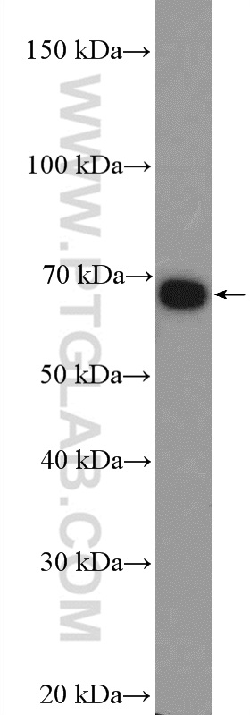 WB analysis of A431 using 55270-1-AP