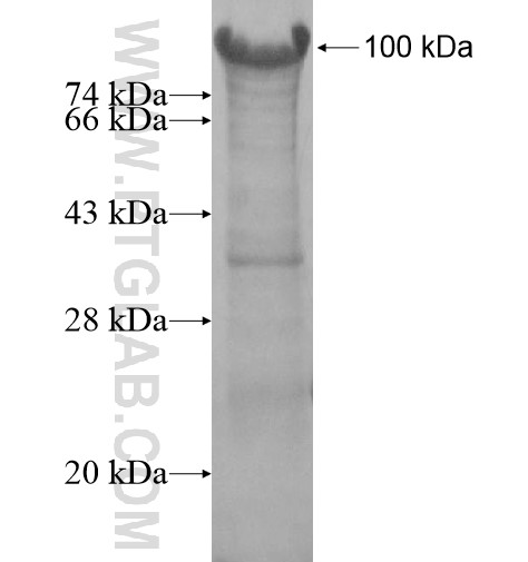 ZBTB43 fusion protein Ag14618 SDS-PAGE ZBTB43 fusion protein Ag14618 SDS-PAGE