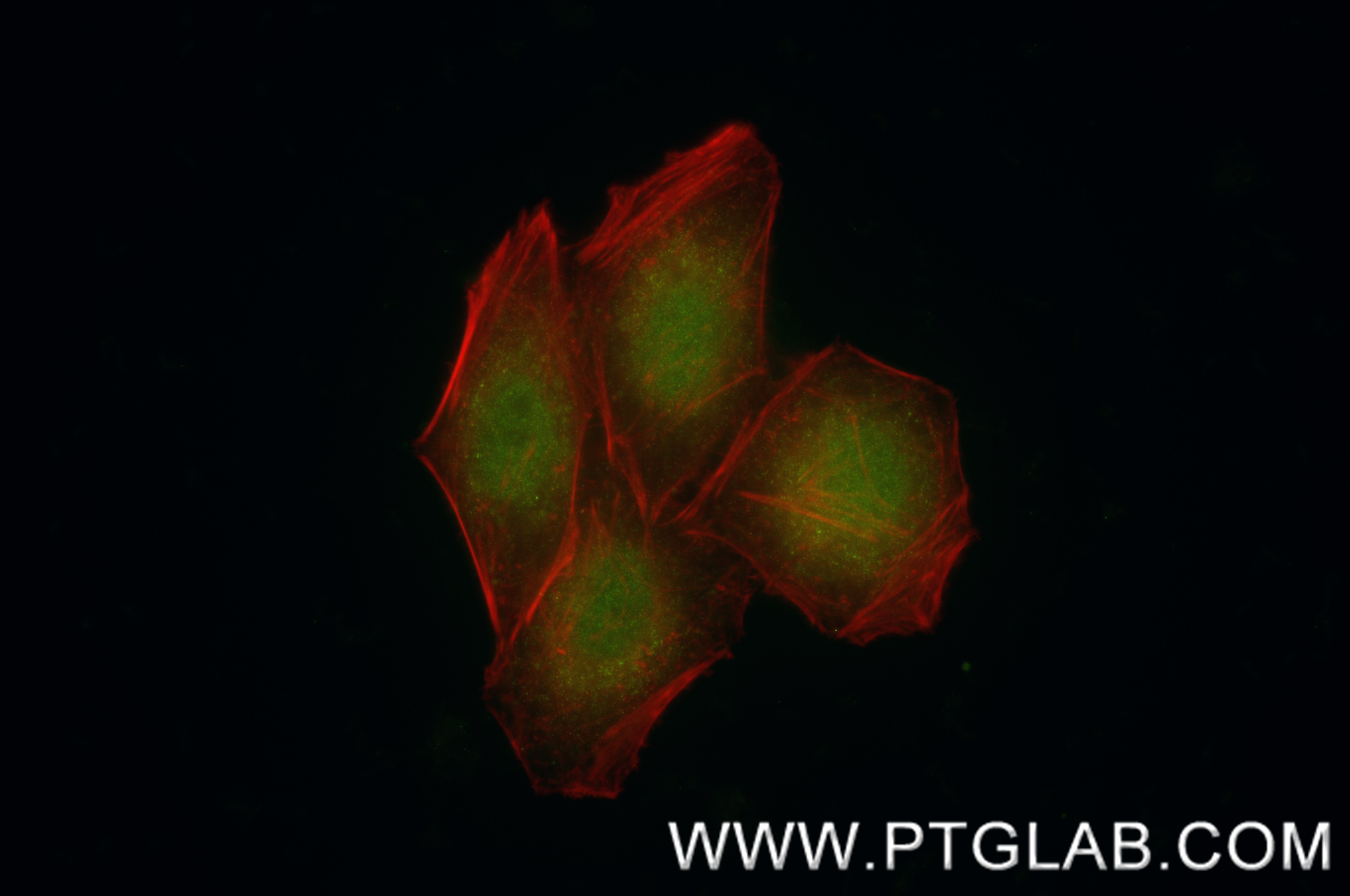 IF Staining of HepG2 using 86981-1-RR (same clone as 86981-1-PBS) IF Staining of HepG2 using 86981-1-RR (same clone as 86981-1-PBS)