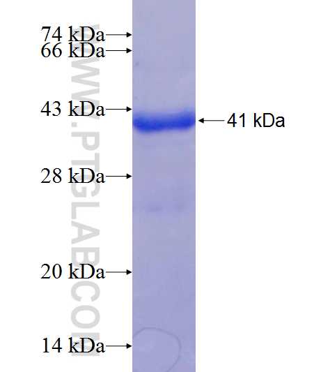 ZBTB48 fusion protein Ag20499 SDS-PAGE ZBTB48 fusion protein Ag20499 SDS-PAGE