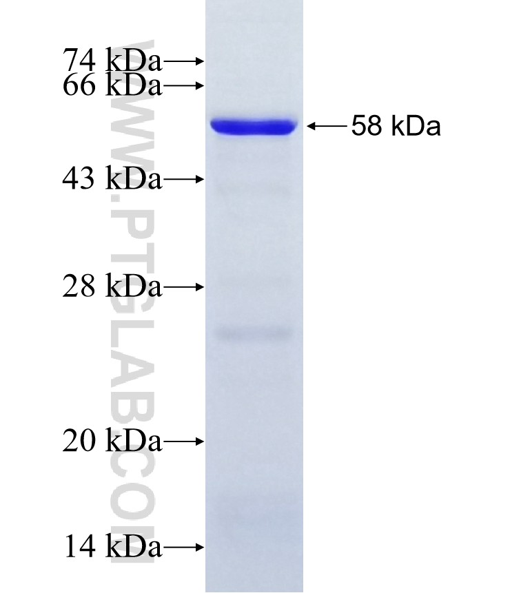 ZBTB6 fusion protein Ag11203 SDS-PAGE ZBTB6 fusion protein Ag11203 SDS-PAGE