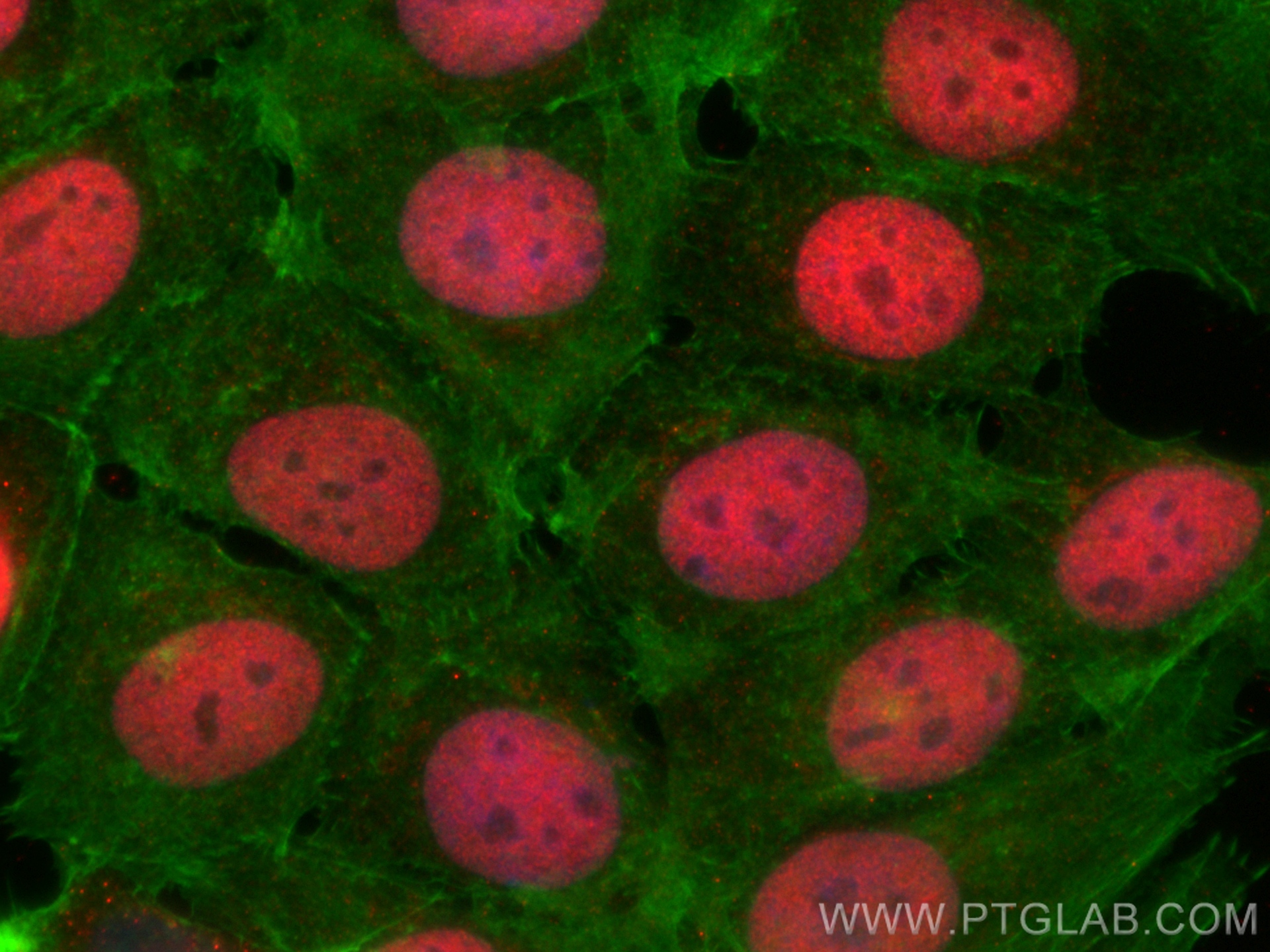 IF Staining of MCF-7 using 18700-1-AP