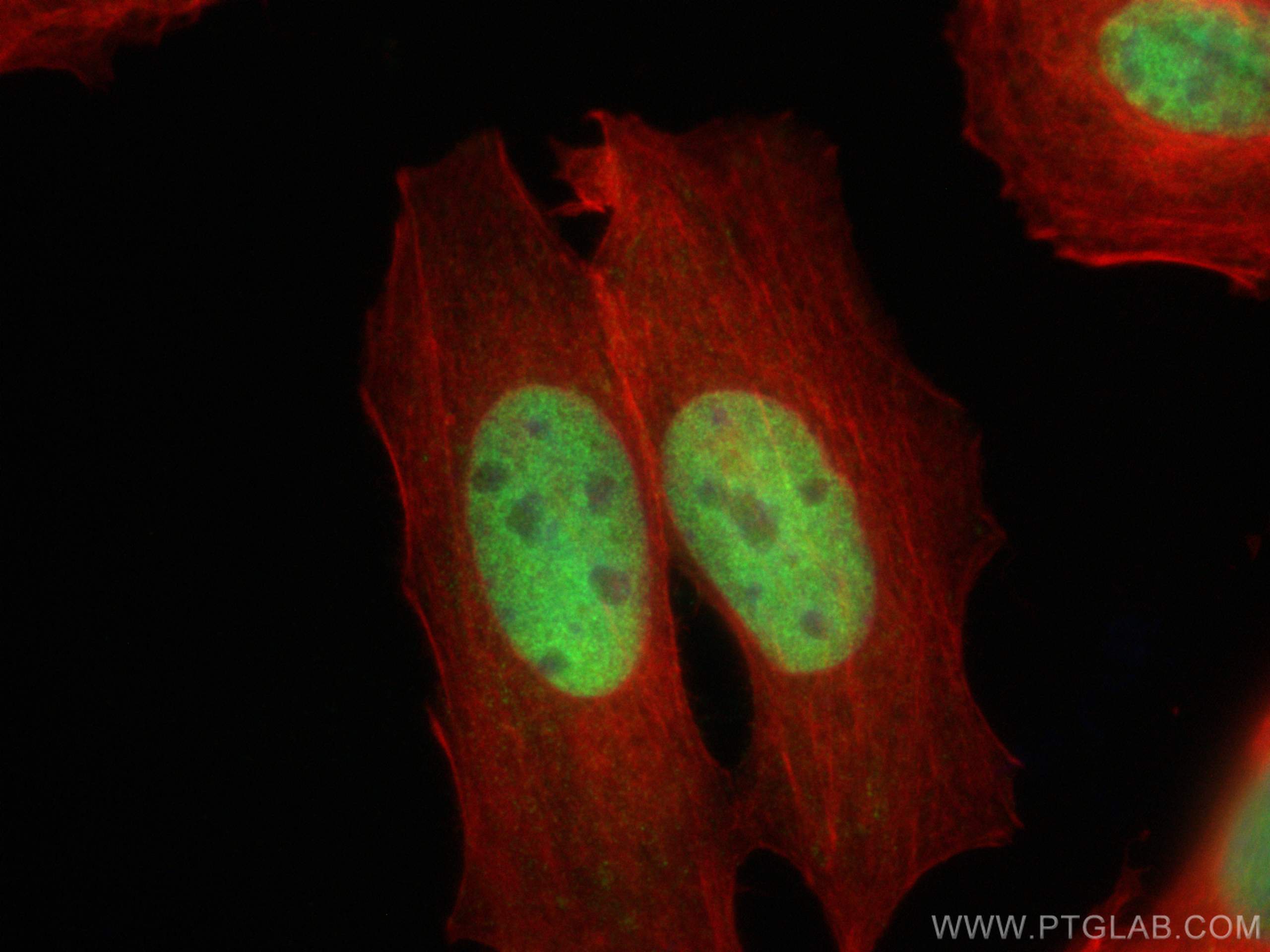 IF Staining of MCF-7 using 30658-1-AP