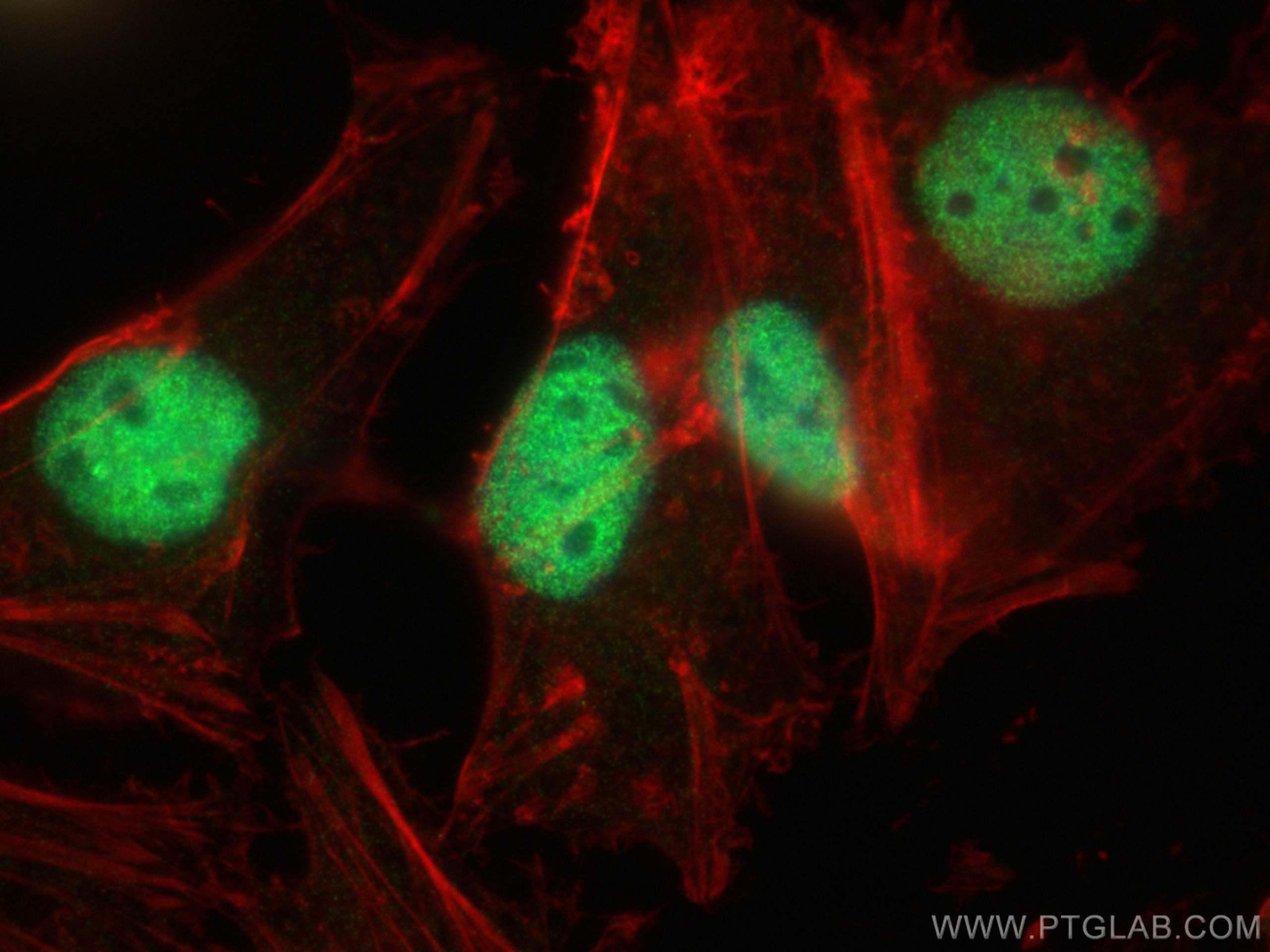 IF Staining of HeLa using 30658-1-AP