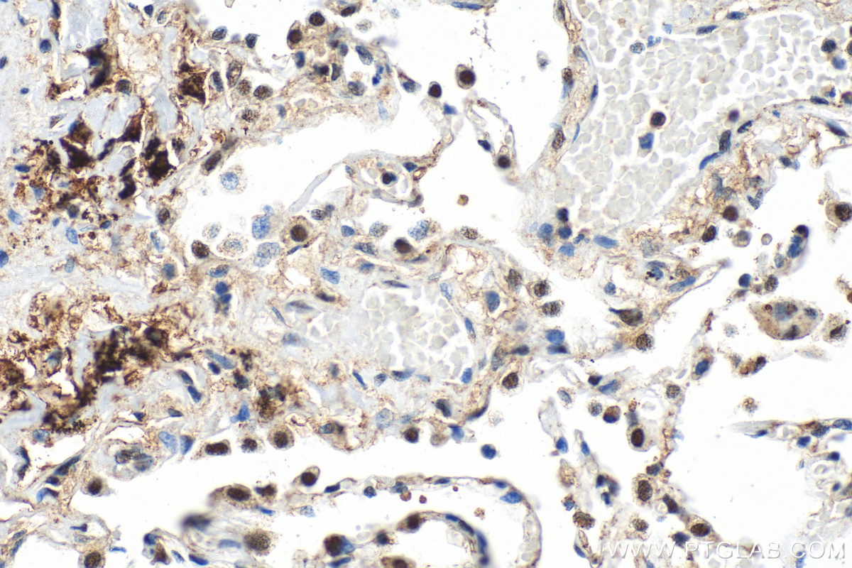 IHC staining of human lung using 30658-1-AP