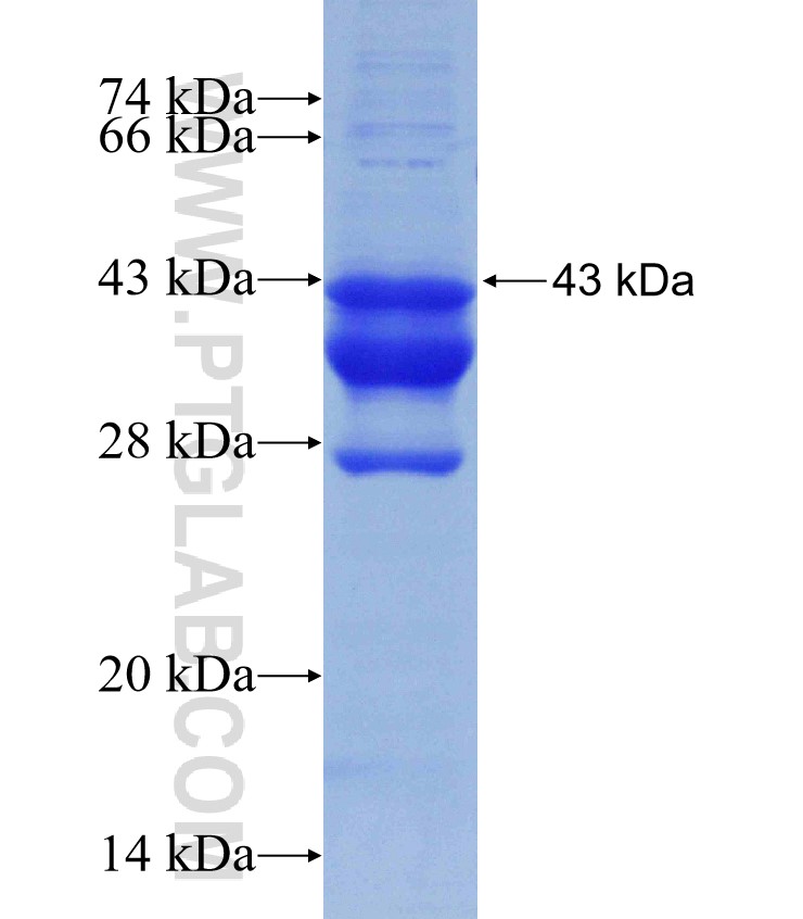 ZBTB7A fusion protein Ag31077 SDS-PAGE