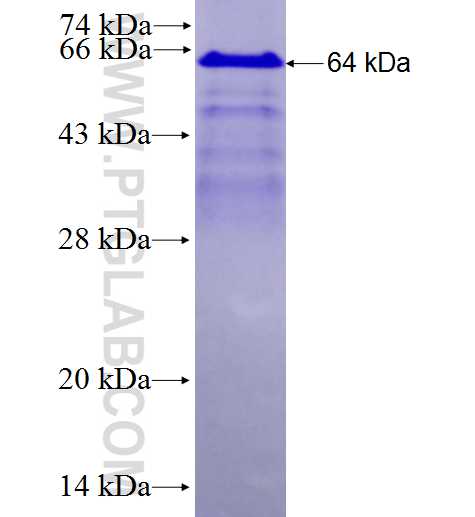 ZBTB7B fusion protein Ag27970 SDS-PAGE