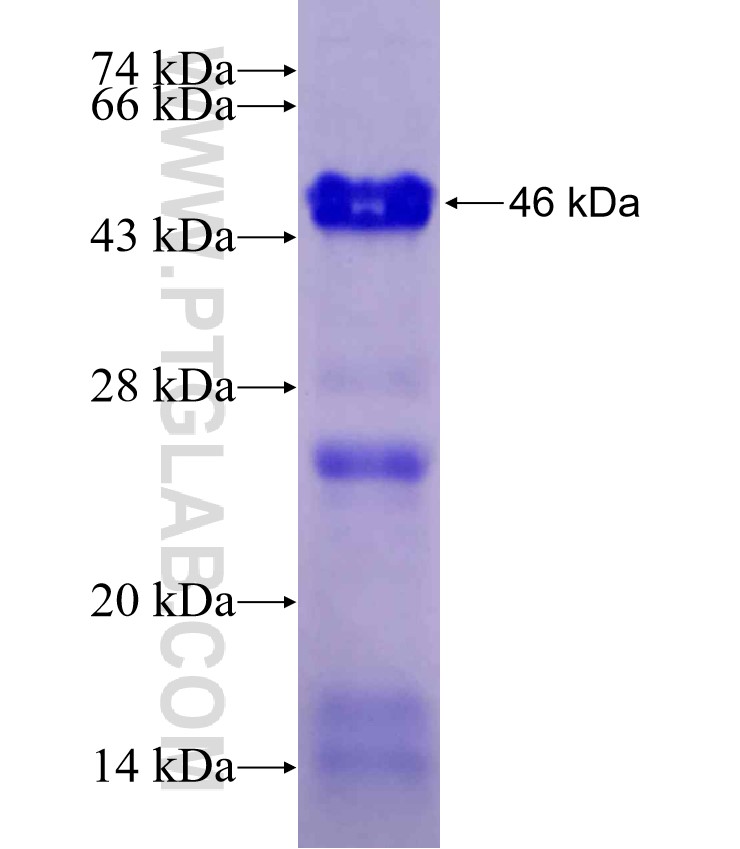 ZBTB7B fusion protein Ag27982 SDS-PAGE
