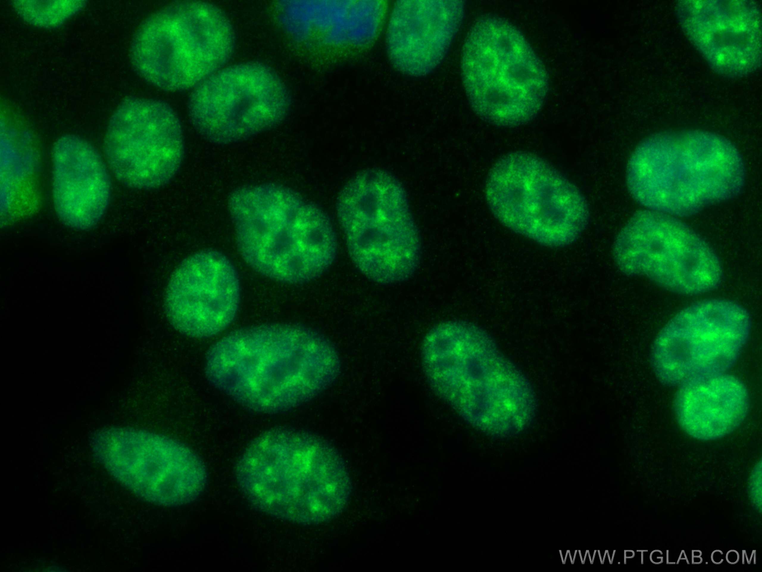IF Staining of HEK-293 using 26081-1-AP (same clone as 26081-1-PBS)