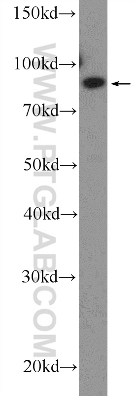 WB analysis of mouse ovary using 26081-1-AP (same clone as 26081-1-PBS)