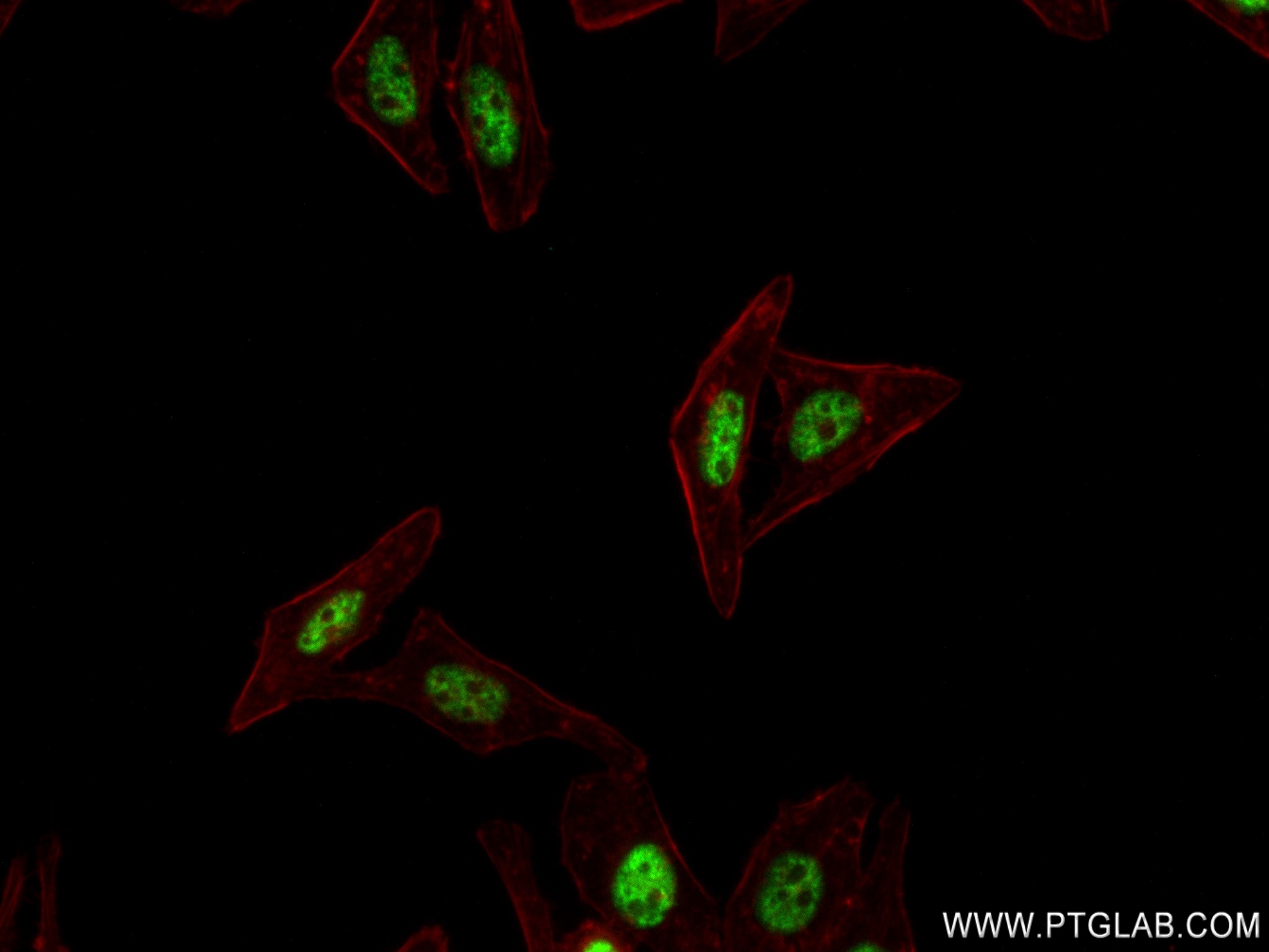 IF Staining of HepG2 using 82912-5-RR