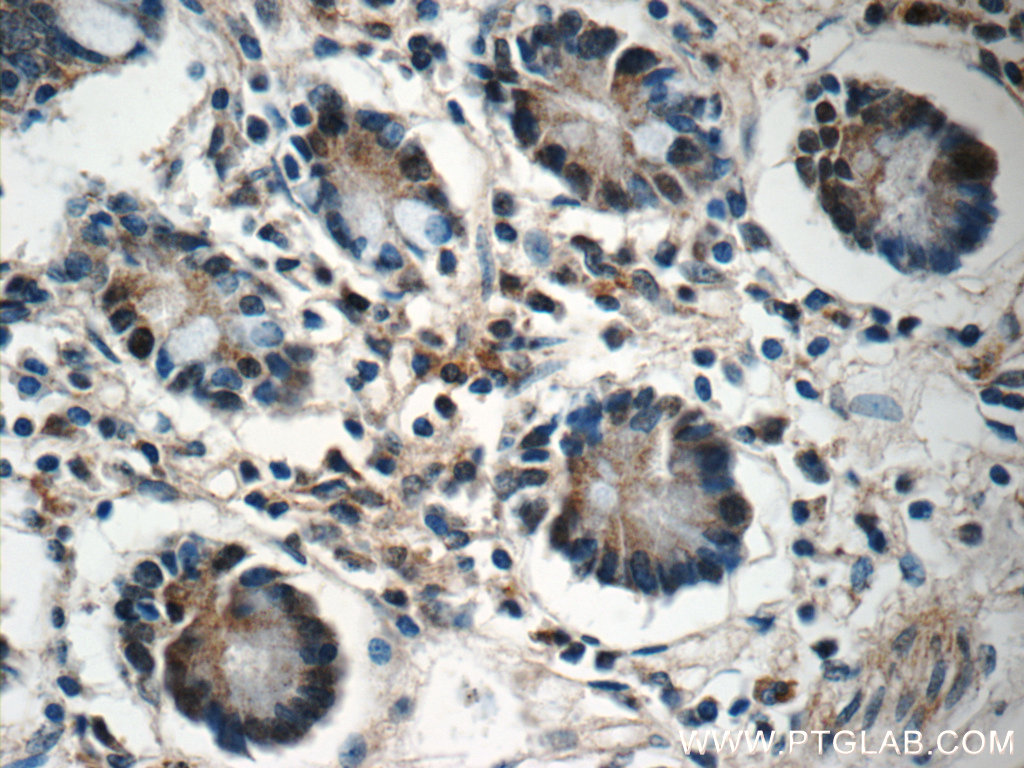 IHC staining of human small intestine using 25009-1-AP