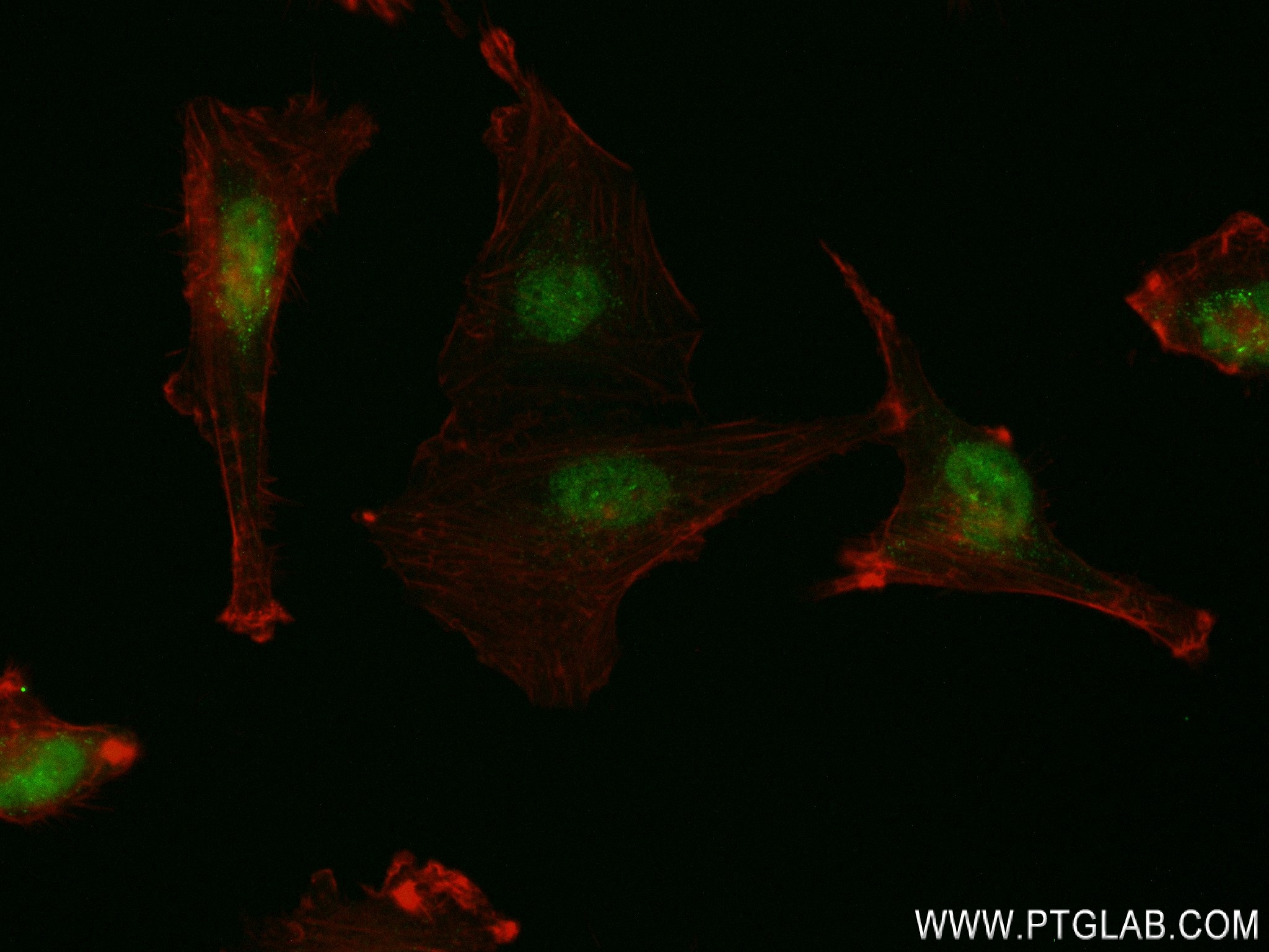 IF Staining of U-251 using 84521-5-RR