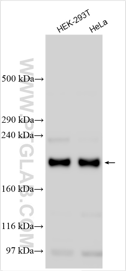 WB analysis using 28430-1-AP