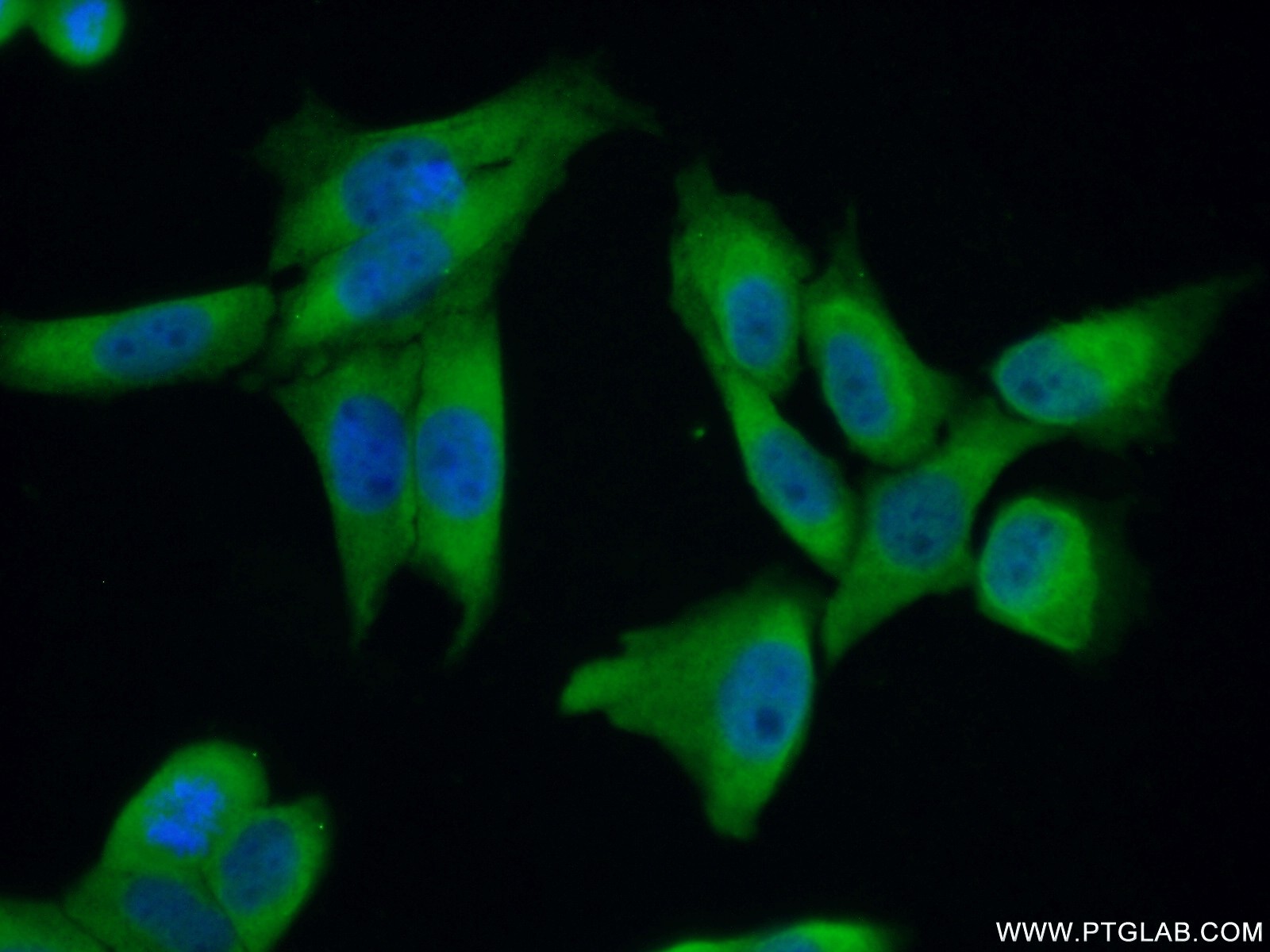 IF Staining of HeLa using 26241-1-AP