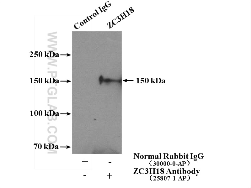 IP experiment of HeLa using 25807-1-AP