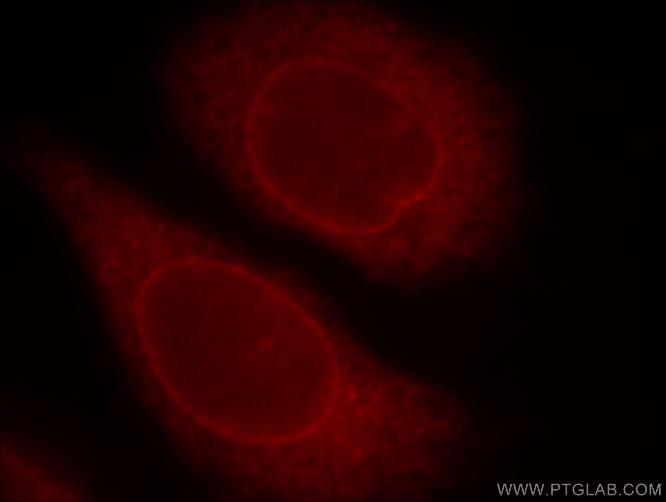 IF Staining of HeLa using 20041-1-AP