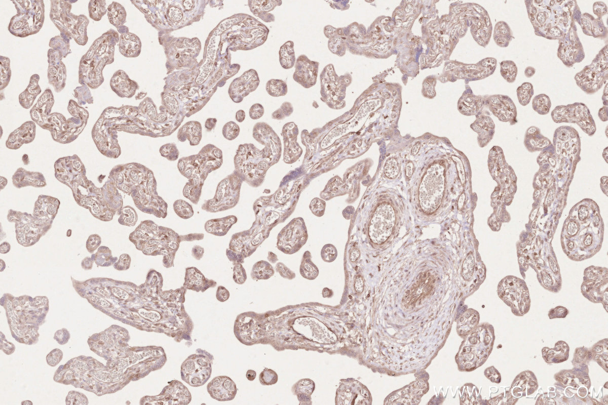 IHC staining of human placenta using 16820-1-AP IHC staining of human placenta using 16820-1-AP