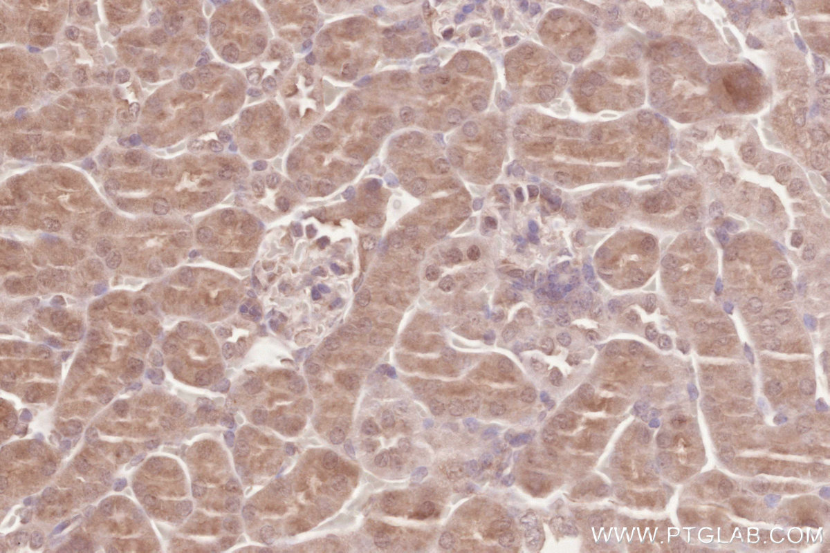 IHC staining of mouse kidney using 16820-1-AP IHC staining of mouse kidney using 16820-1-AP
