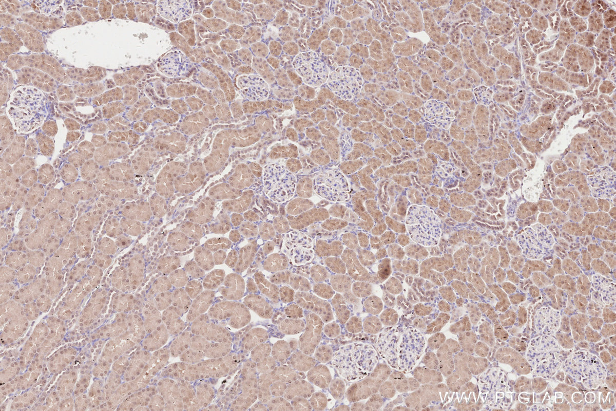IHC staining of rat kidney using 16820-1-AP IHC staining of rat kidney using 16820-1-AP