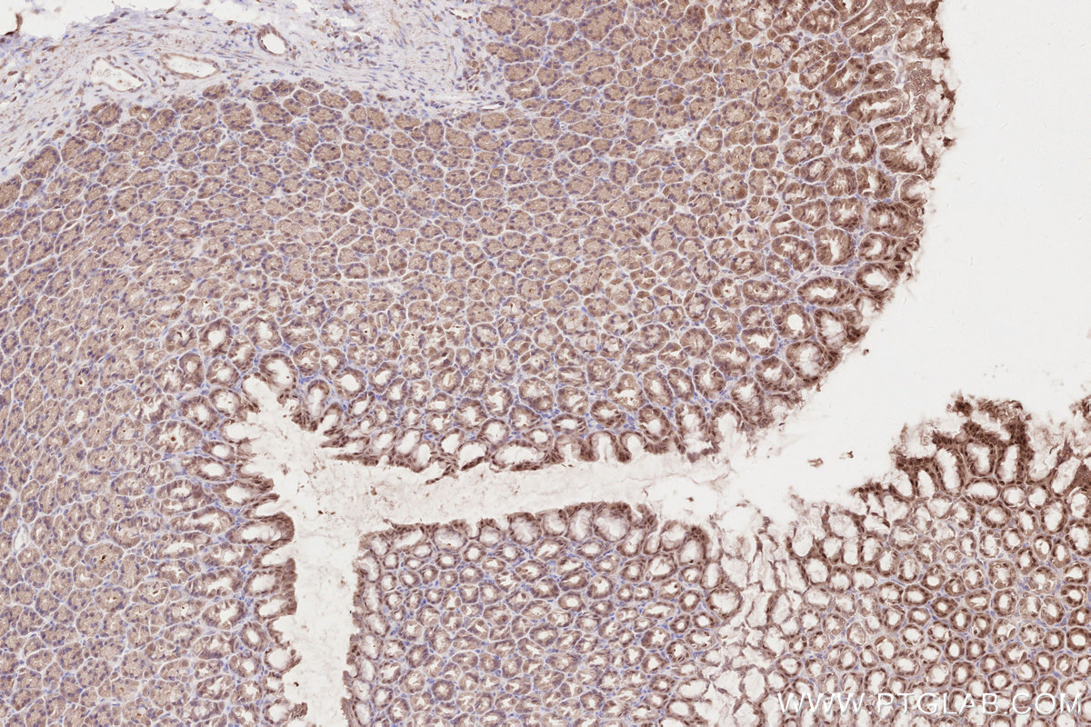 IHC staining of rat stomach using 16820-1-AP IHC staining of rat stomach using 16820-1-AP