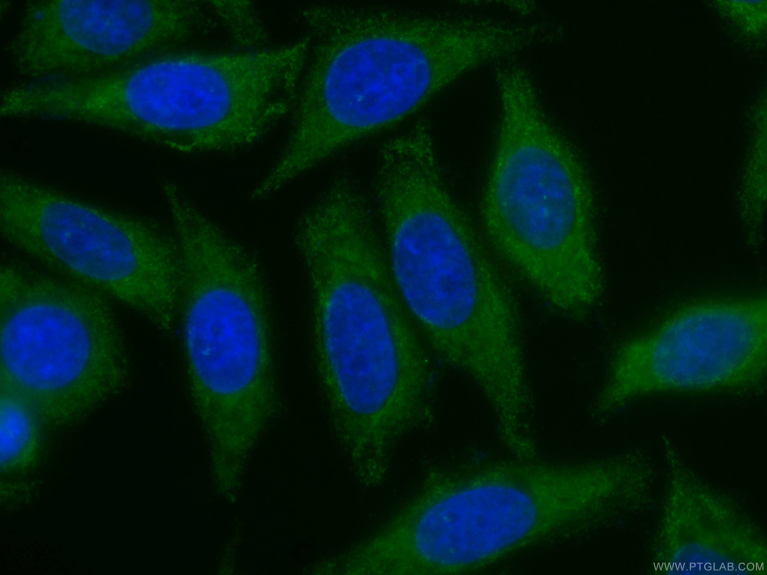 IF Staining of HepG2 using CL488-66413