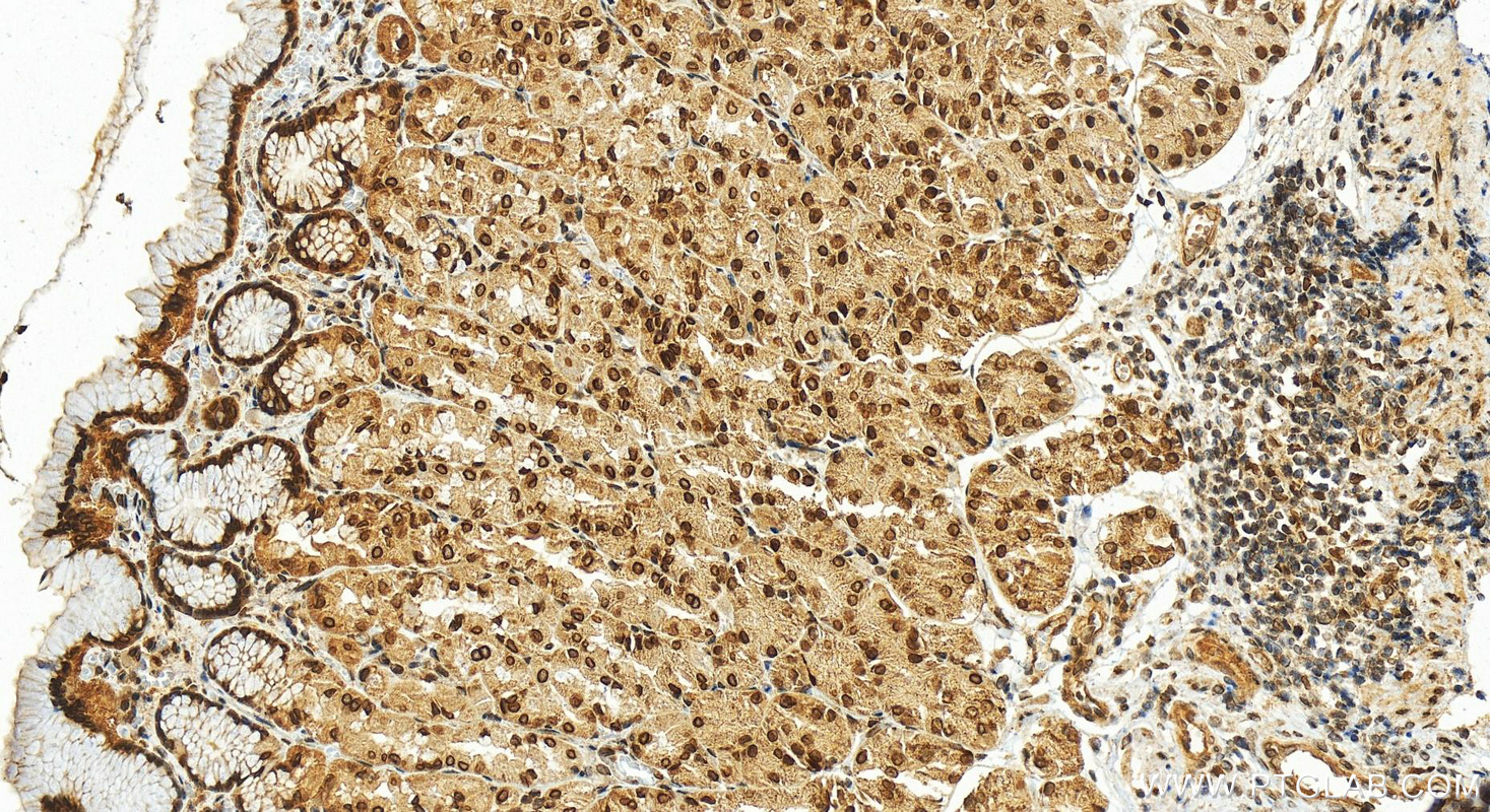 IHC staining of human stomach using 13148-1-AP
