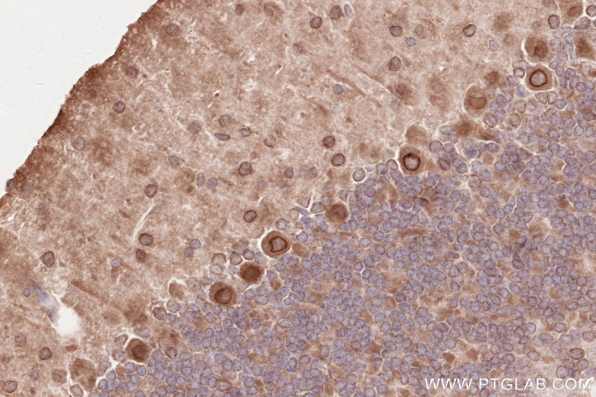 IHC staining of mouse cerebellum using 13148-1-AP IHC staining of mouse cerebellum using 13148-1-AP