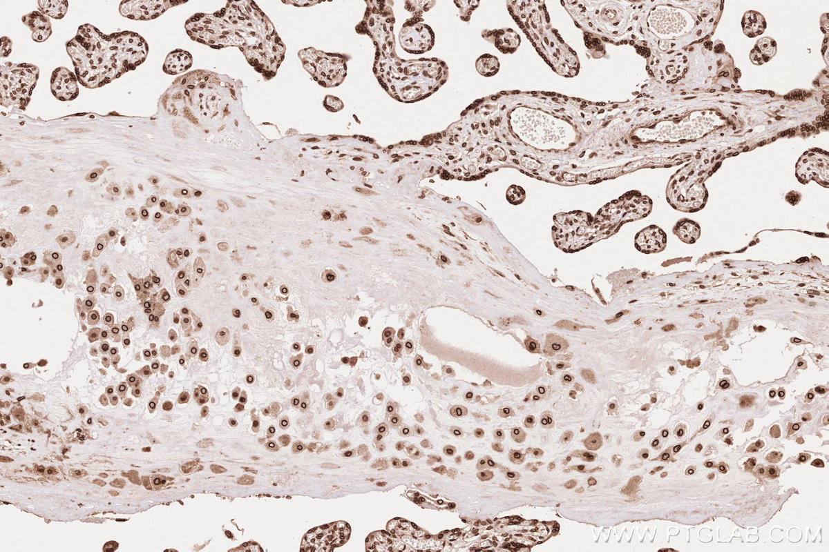 IHC staining of human placenta using 13148-1-AP IHC staining of human placenta using 13148-1-AP