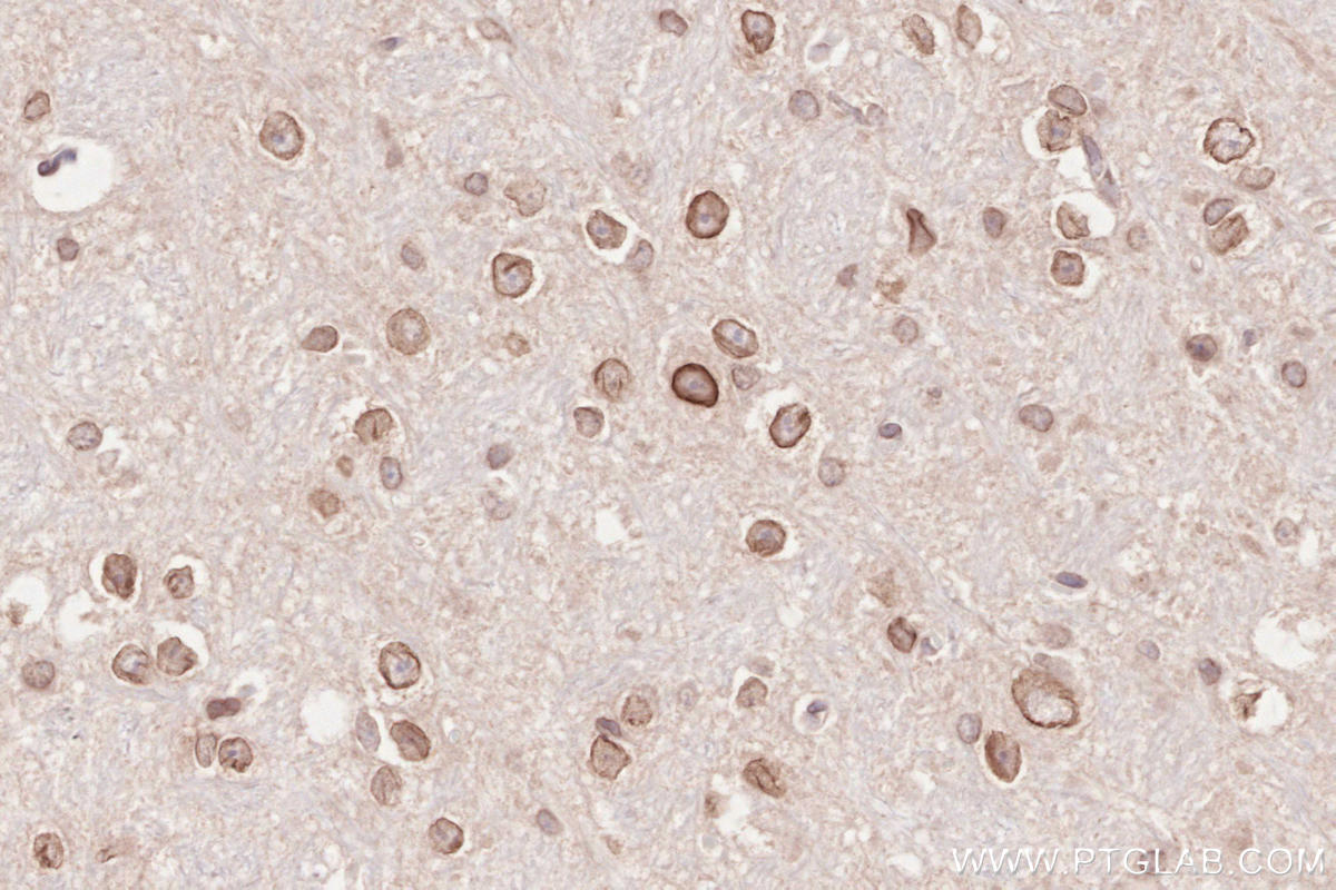 IHC staining of mouse cerebellum using 13148-1-AP IHC staining of mouse cerebellum using 13148-1-AP