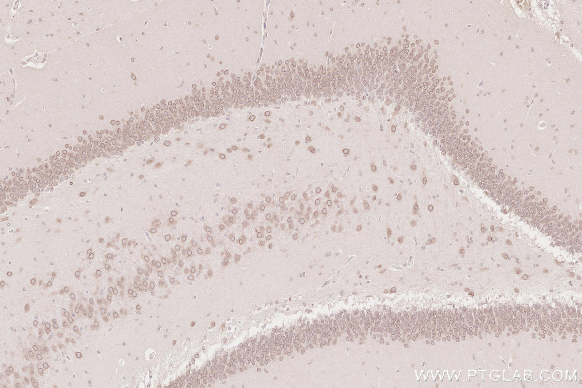 IHC staining of rat brain using 13148-1-AP IHC staining of rat brain using 13148-1-AP