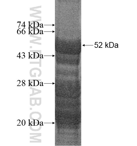 ZC4H2 fusion protein Ag14388 SDS-PAGE ZC4H2 fusion protein Ag14388 SDS-PAGE