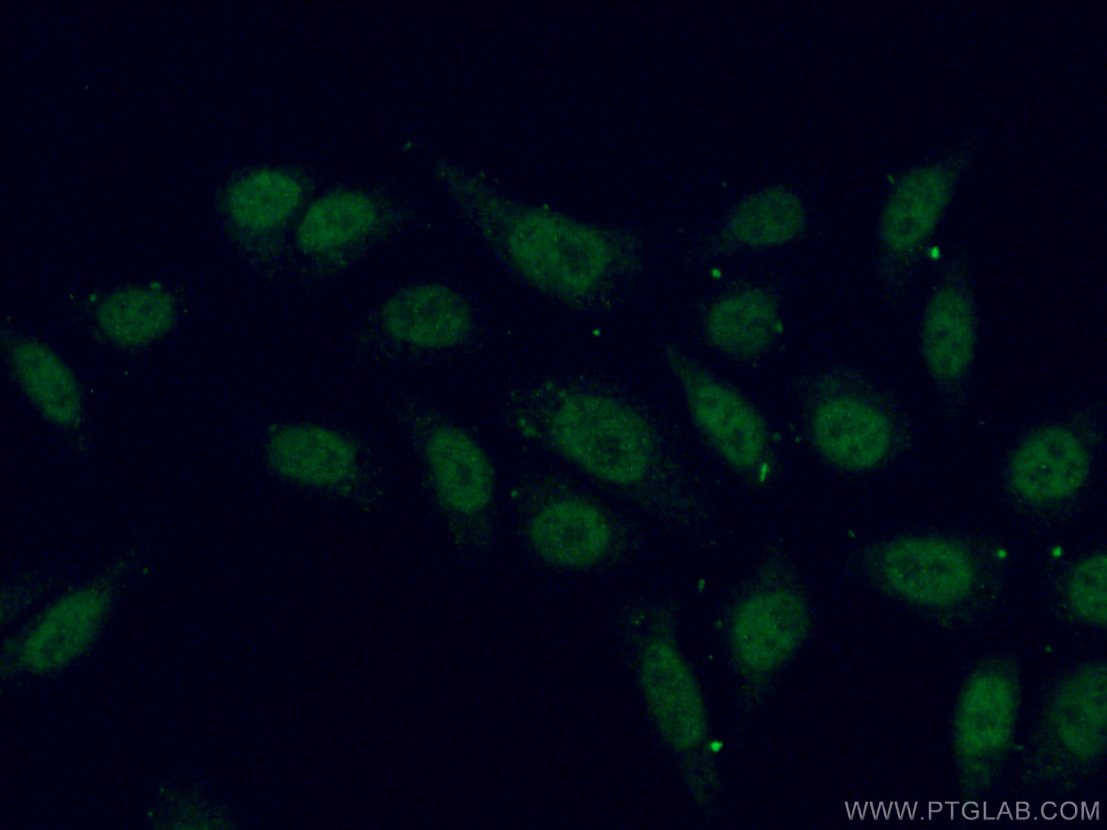 IF Staining of HepG2 using 18980-1-AP