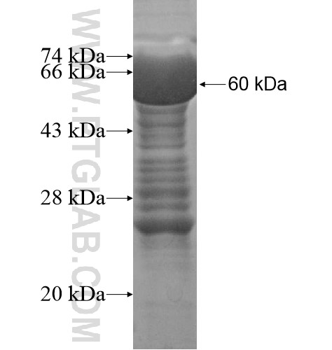 ZCCHC11 fusion protein Ag13661 SDS-PAGE