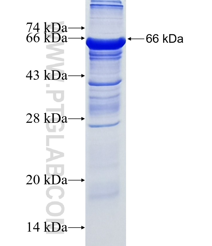 ZCCHC14 fusion protein Ag18792 SDS-PAGE ZCCHC14 fusion protein Ag18792 SDS-PAGE