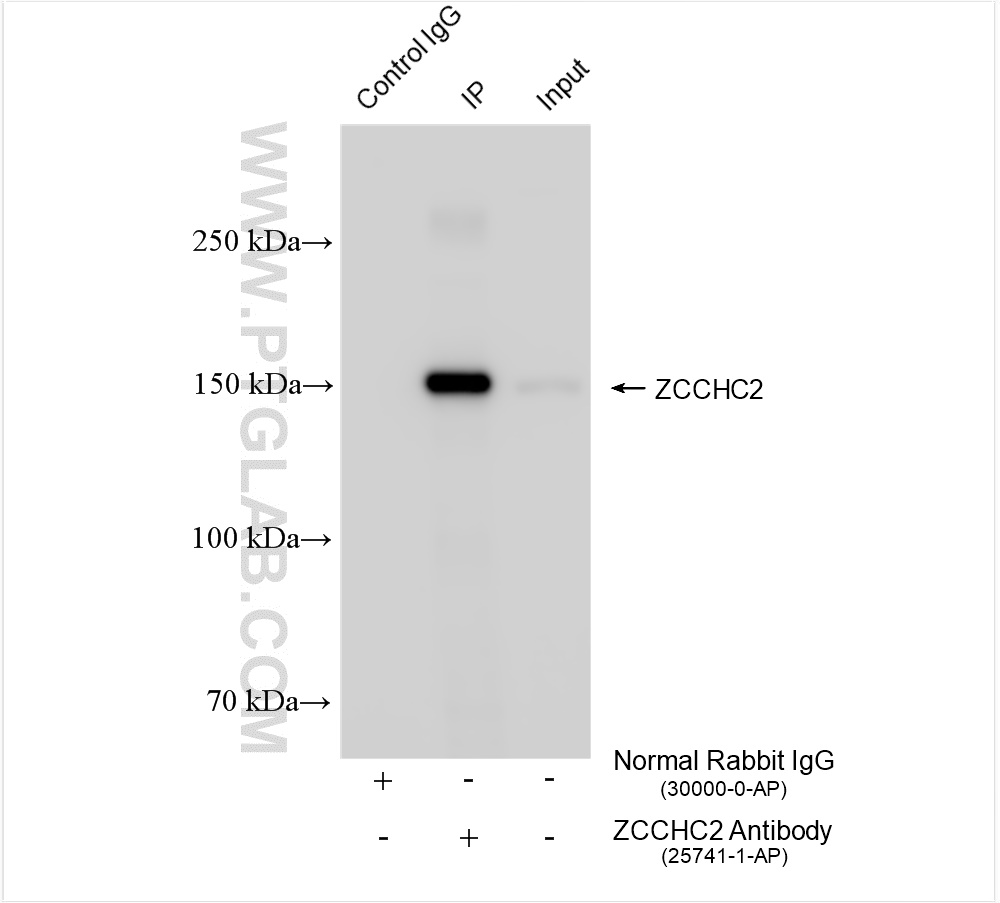 IP experiment of HeLa using 25741-1-AP