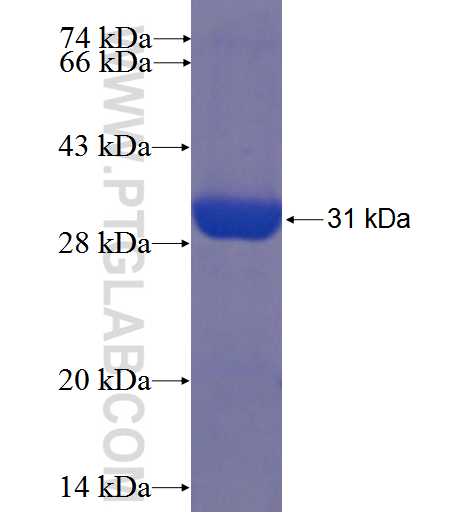 ZCCHC2 fusion protein Ag22744 SDS-PAGE ZCCHC2 fusion protein Ag22744 SDS-PAGE