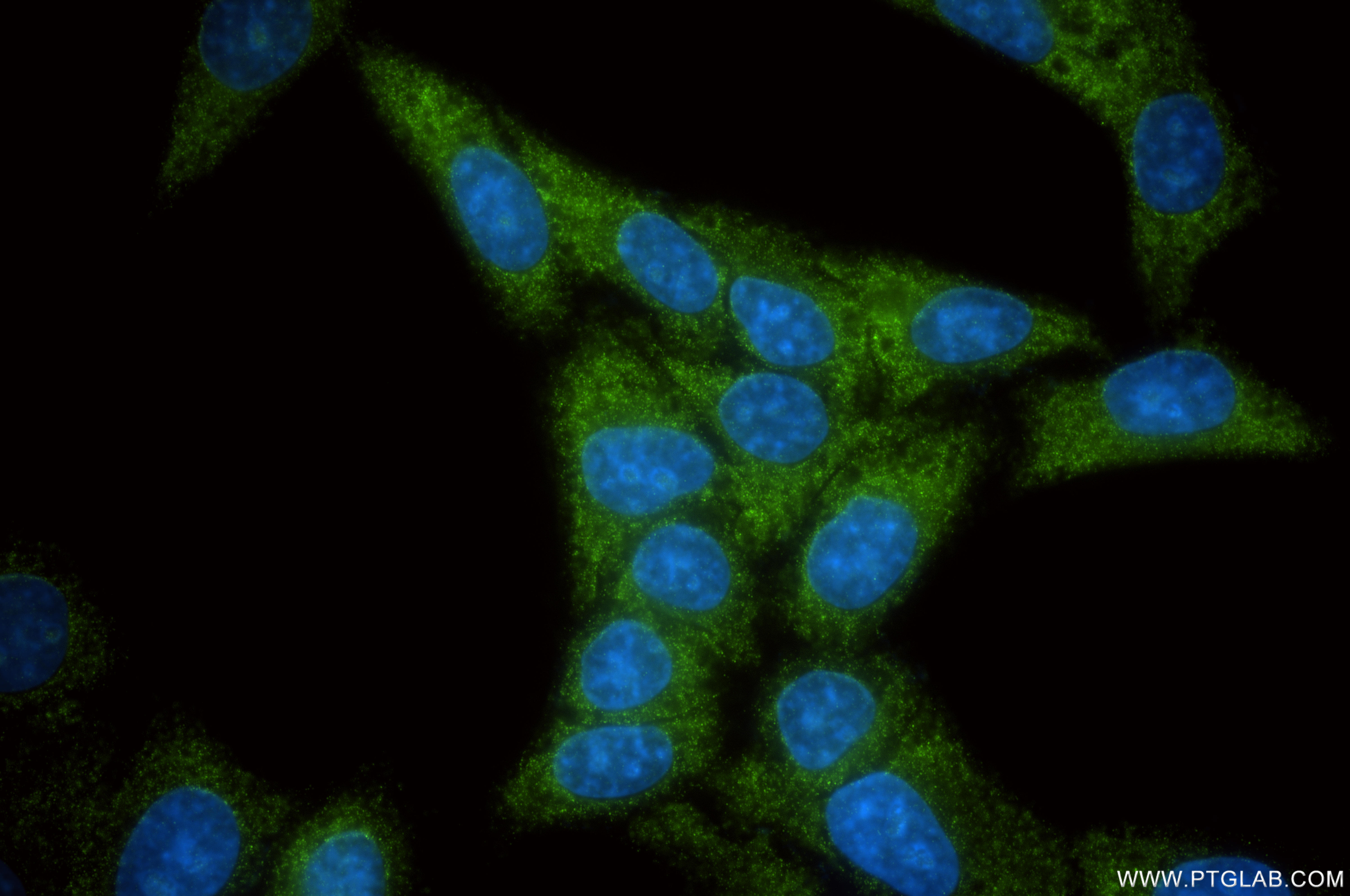 Immunofluorescent analysis of (-20°C Ethanol) fixed HepG2 cells using ZCCHC3 antibody (<a class='green' href='/productredirect?CatalogNo=85721-3-RR' target='_blank'>85721-3-RR</a>, Clone: 250088G1 ) at dilution of 1:200 and CoraLite®488-Conjugated Goat Anti-Rabbit IgG(H+L) (<a class='green' href='/productredirect?CatalogNo=SA00013-2' target='_blank'>SA00013-2</a>). This data was developed using the same antibody clone with 85721-3-PBS in a different storage buffer formulation. IF Staining of HepG2 using 85721-3-RR (same clone as 85721-3-PBS)