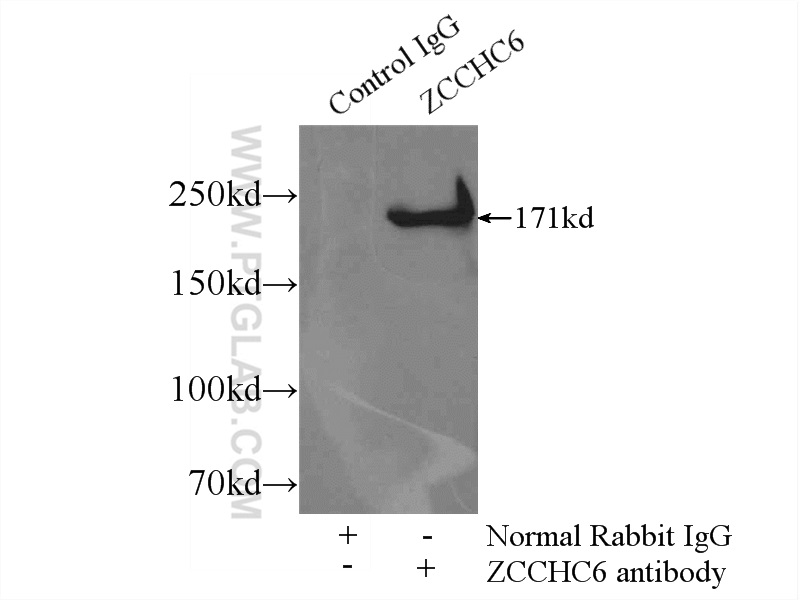 IP experiment of HeLa using 25196-1-AP