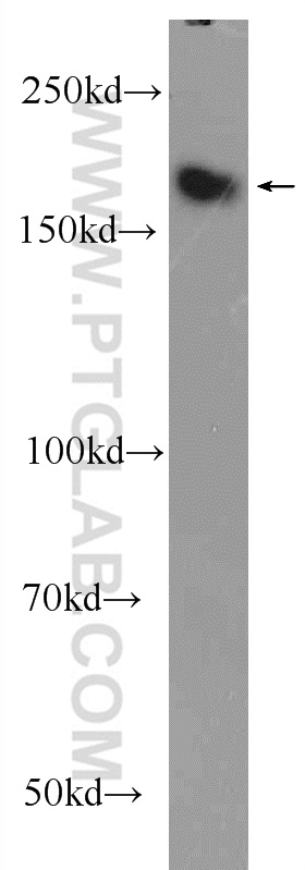 ZCCHC6 Polyclonal antibody