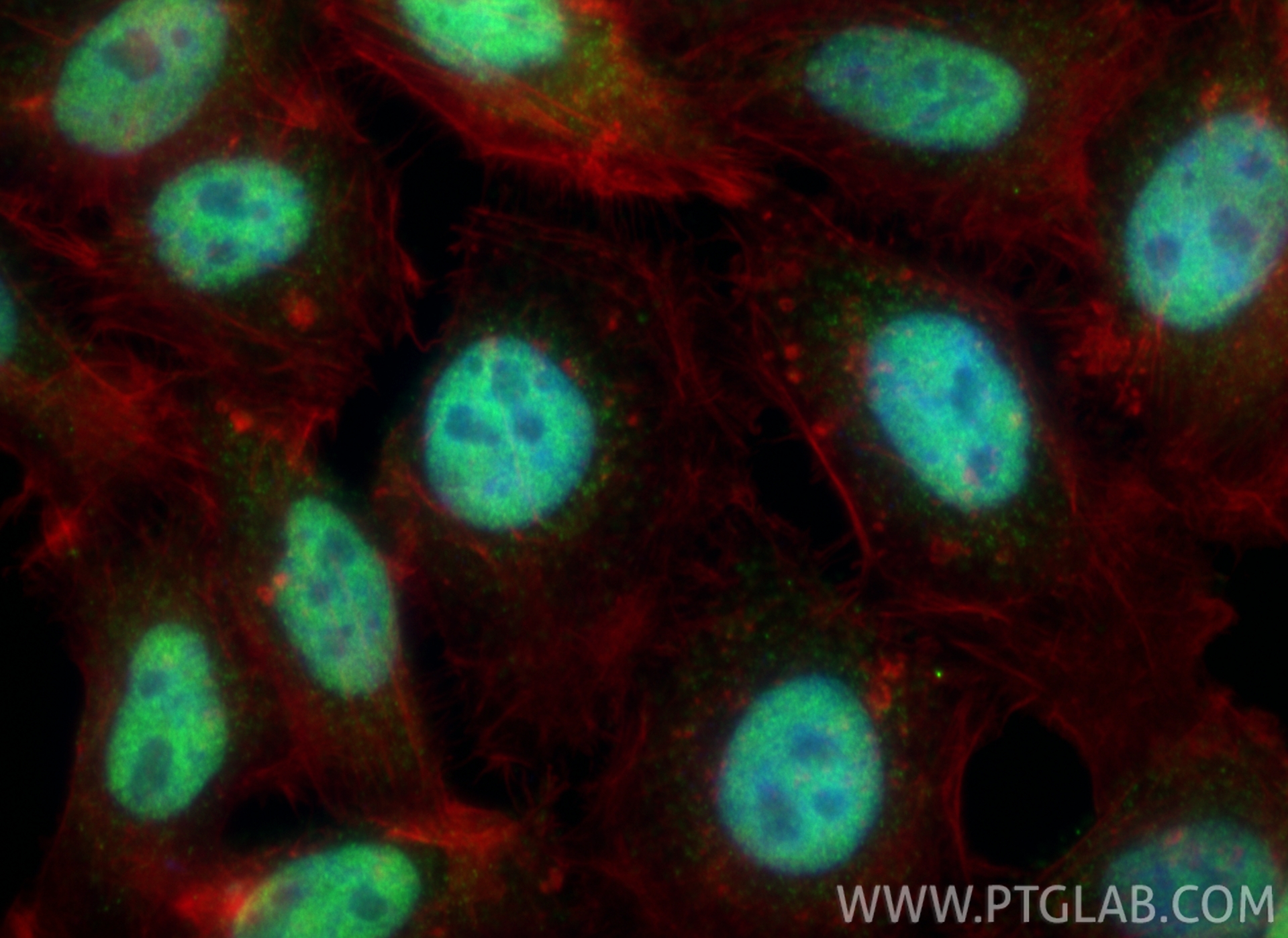 Immunofluorescent analysis of (4% PFA) fixed HepG2 cells using ZCCHC8 antibody (23374-1-AP) at dilution of 1:400 and CoraLite®488-Conjugated Goat Anti-Rabbit IgG(H+L) (<a class='green' href='/productredirect?CatalogNo=SA00013-2' target='_blank'>SA00013-2</a>), CL594-phalloidin (red). IF Staining of HepG2 using 23374-1-AP