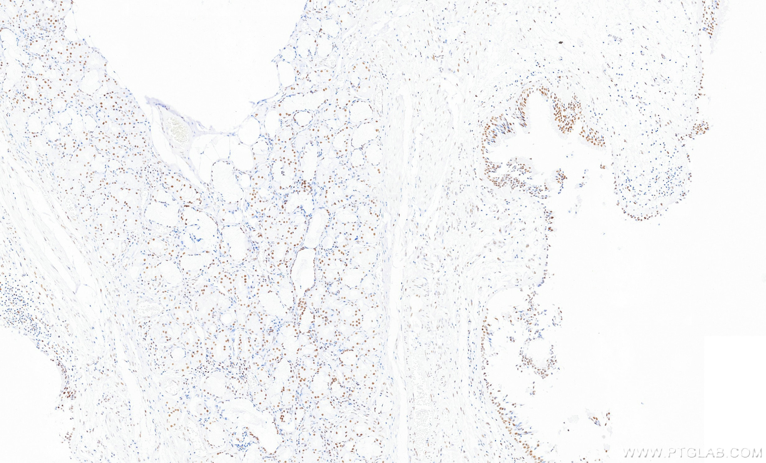 IHC staining of human lung using 87017-1-RR (same clone as 87017-1-PBS) IHC staining of human lung using 87017-1-RR (same clone as 87017-1-PBS)