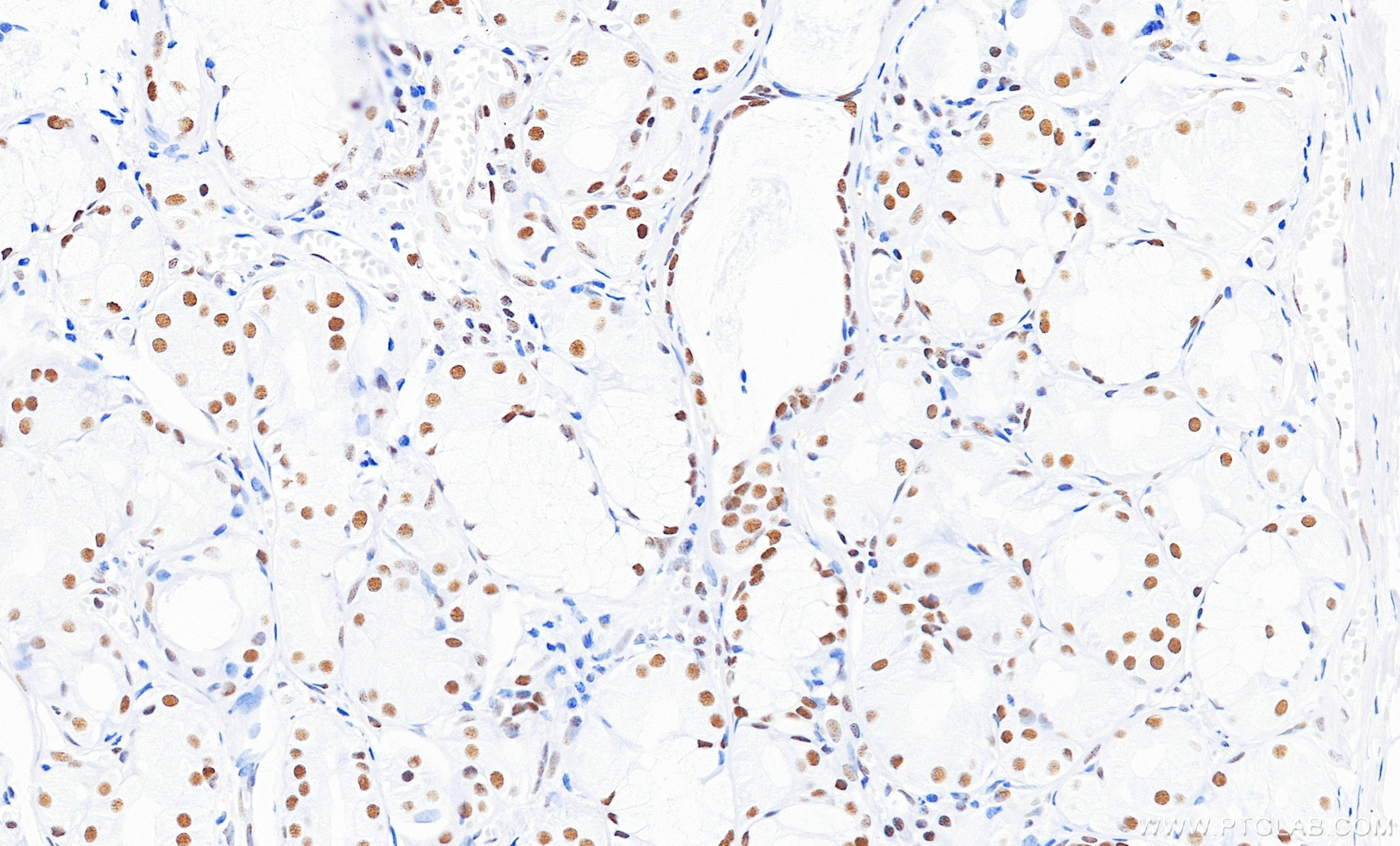 IHC staining of human lung using 87017-1-RR (same clone as 87017-1-PBS) IHC staining of human lung using 87017-1-RR (same clone as 87017-1-PBS)