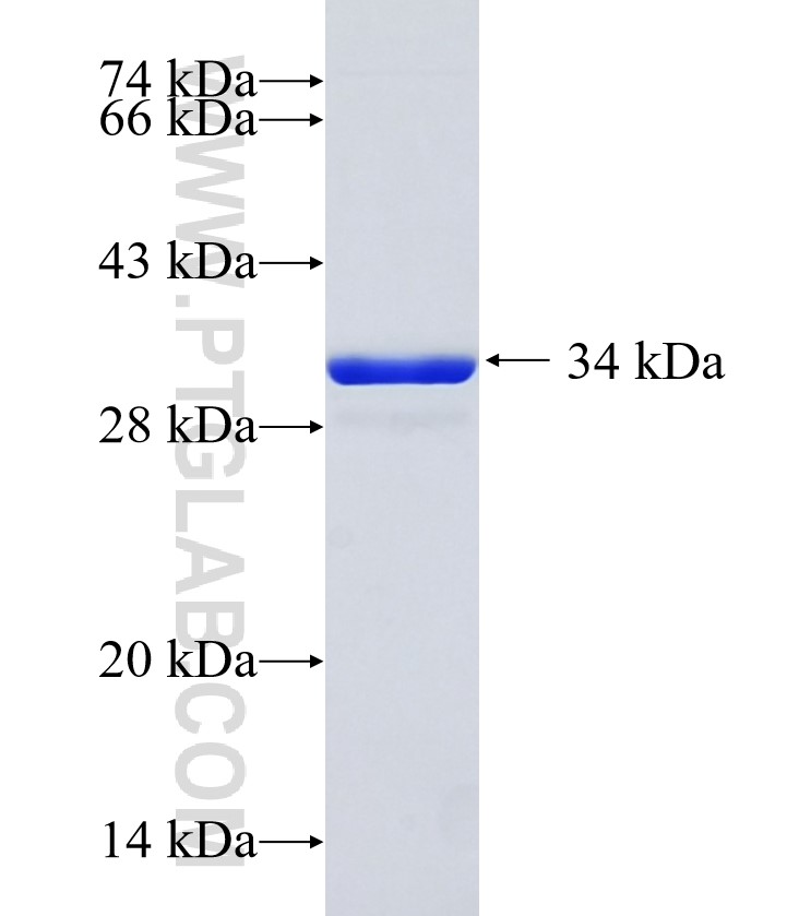 ZDHHC11 fusion protein Ag22141 SDS-PAGE ZDHHC11 fusion protein Ag22141 SDS-PAGE