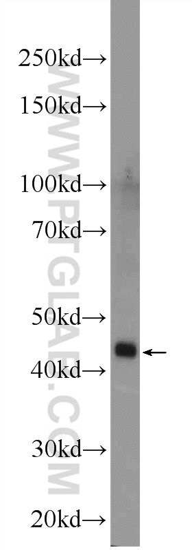 WB analysis of mouse kidney using 24759-1-AP